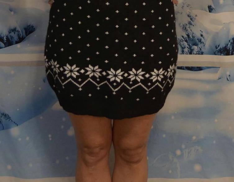 Sexy Ugly Christmas Sweater dress, it is NOT A PLASTIC boob, cut out, see details, boob, breast, jumper, reindeer boob, multi size, fun